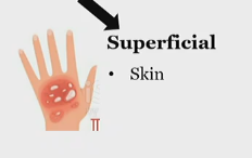 <p>Superficial somatic pain, nociceptive</p>