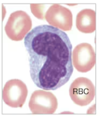 <p>What White Blood Cell is being displayed?</p>