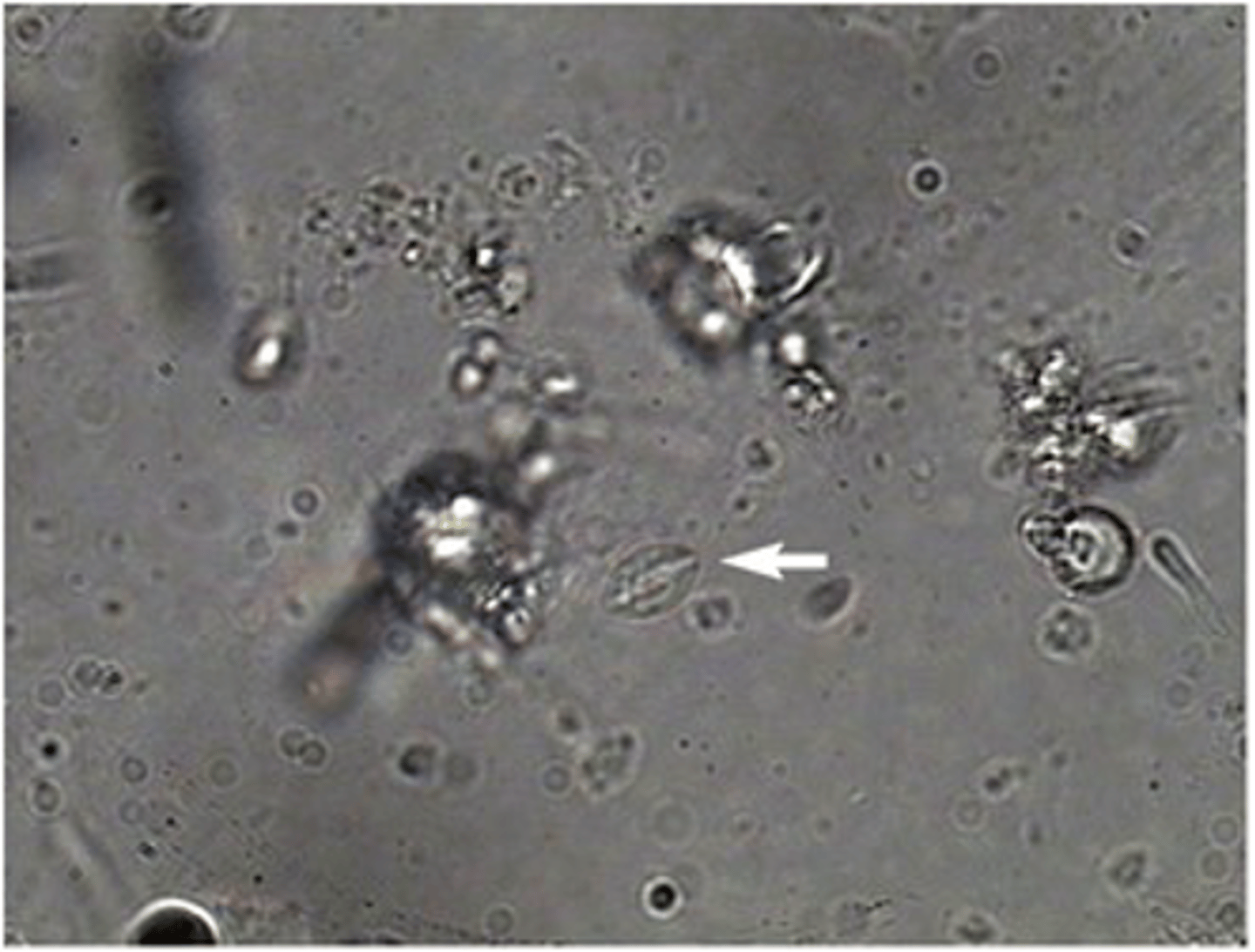 <p>This mastigophoran parasite was once given a genus and species. It has since been</p><p>changed to a genus and ________.</p>