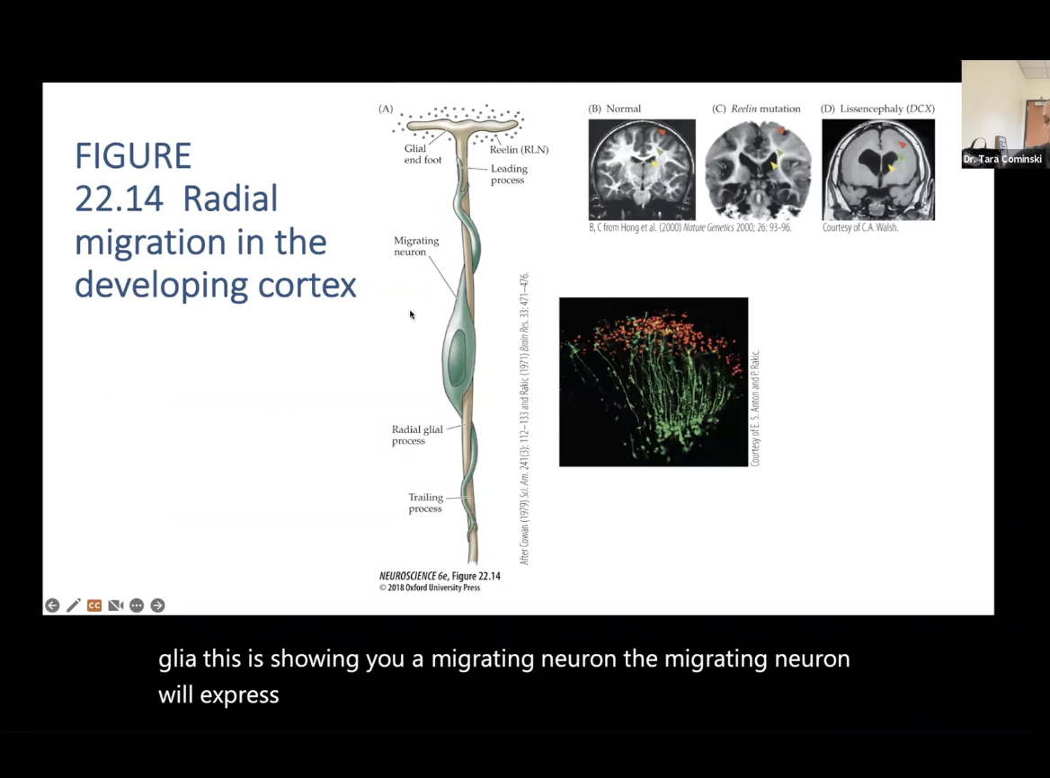 <p>Migration of Neurons: Figure 22.14- <strong>Radial migration in the developing cortex</strong></p>