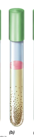 <p>Fluid Thioglycollate test- colonies on bottom of tube</p>