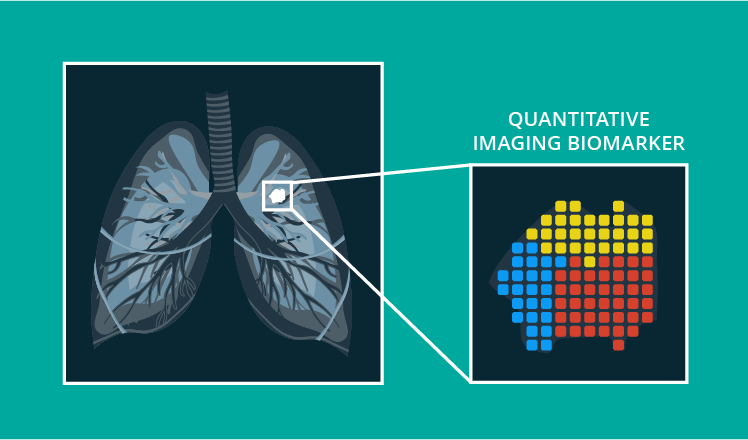 <p>quantitive radiology - measured density of pathology</p>