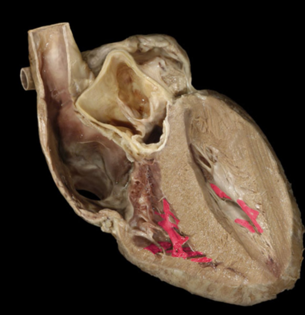 <p>Name the Structure of the Right Ventricle</p>