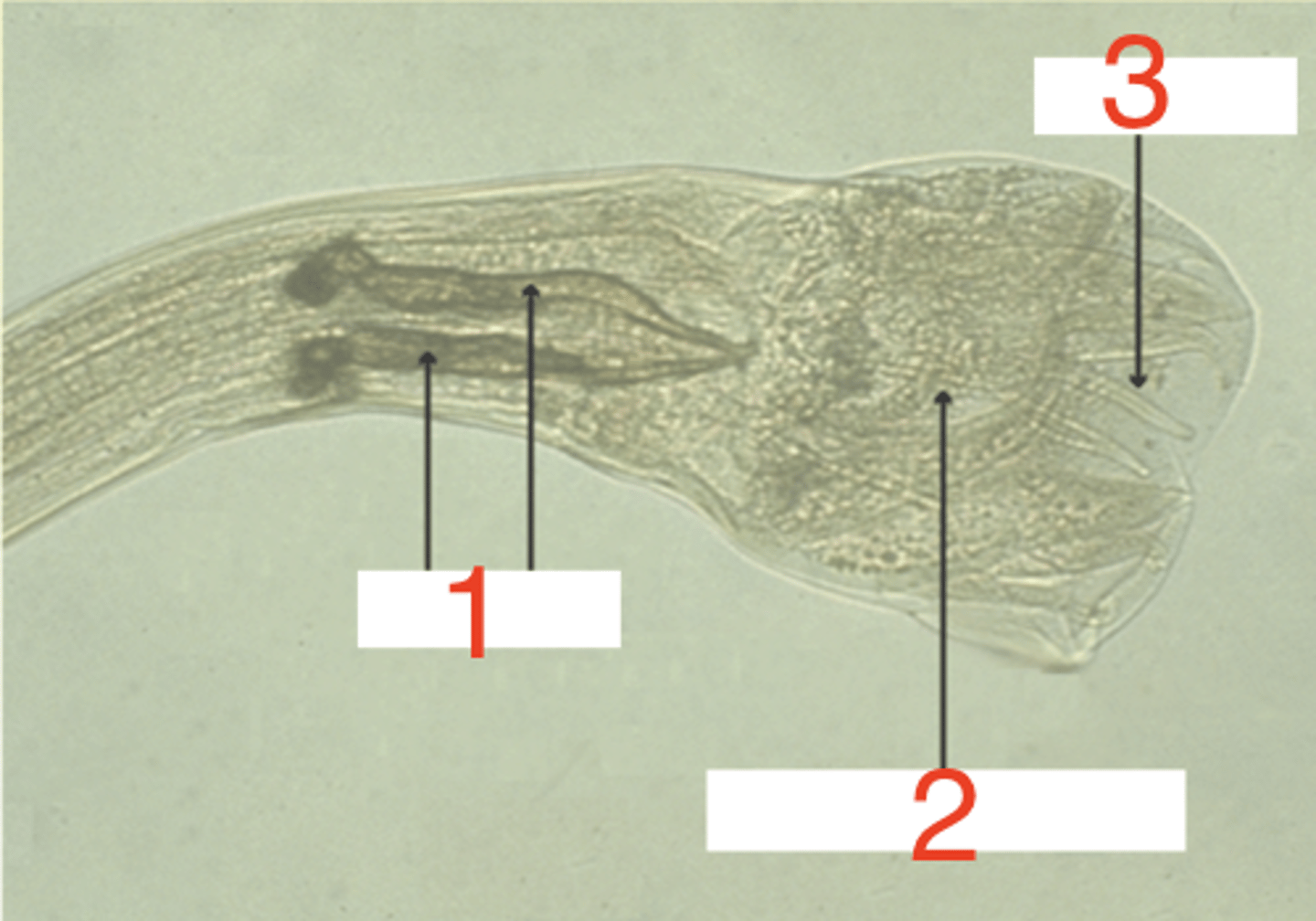 <p>is this a male or female nematode? why?</p>