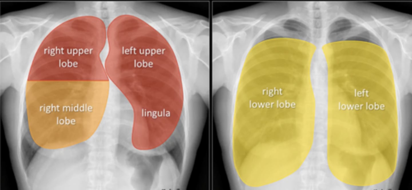 <p>(evaluating AP CXR) evaluation of lung position</p>