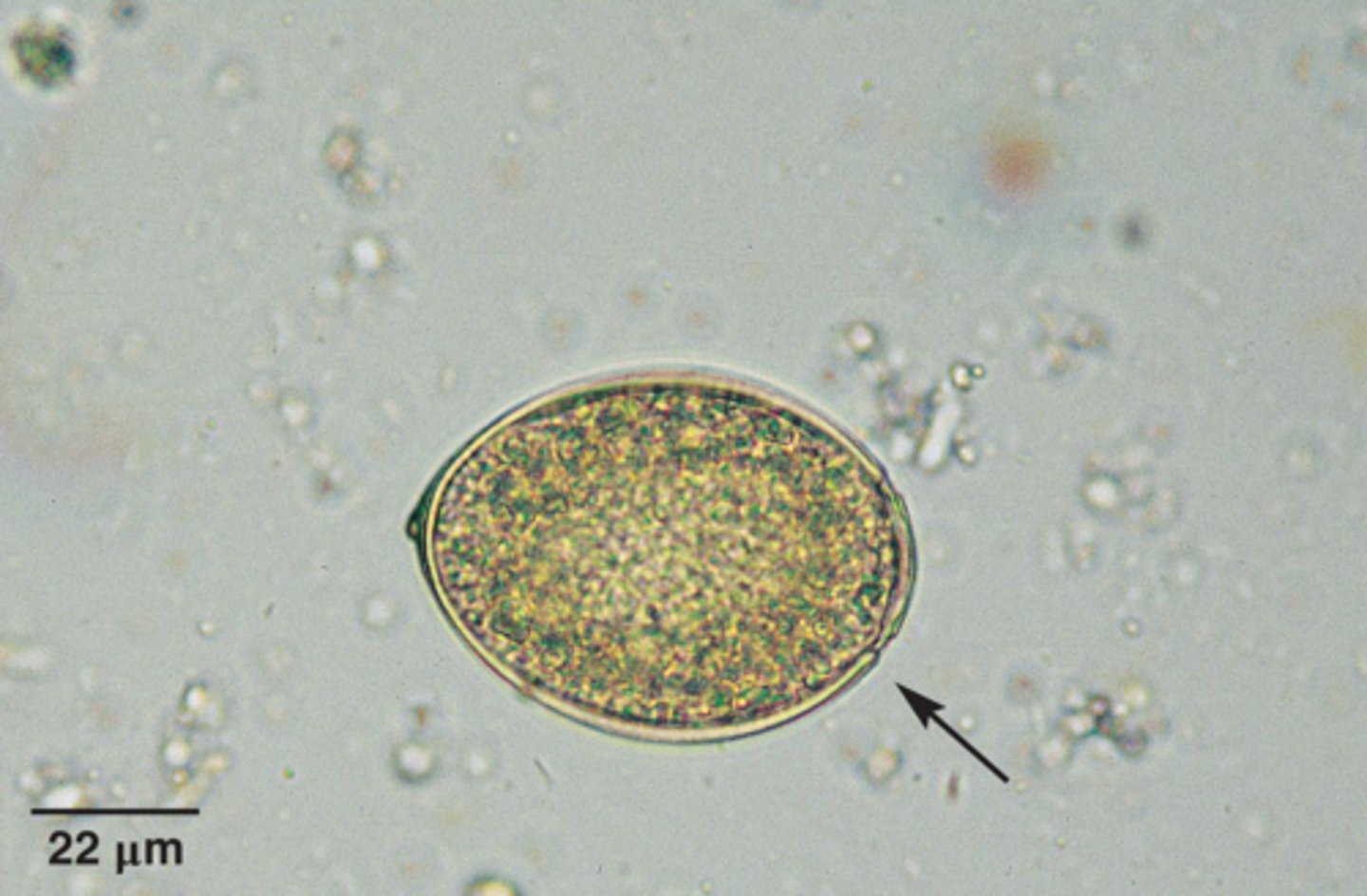 <p>What parasite is this if it is from a cat</p>