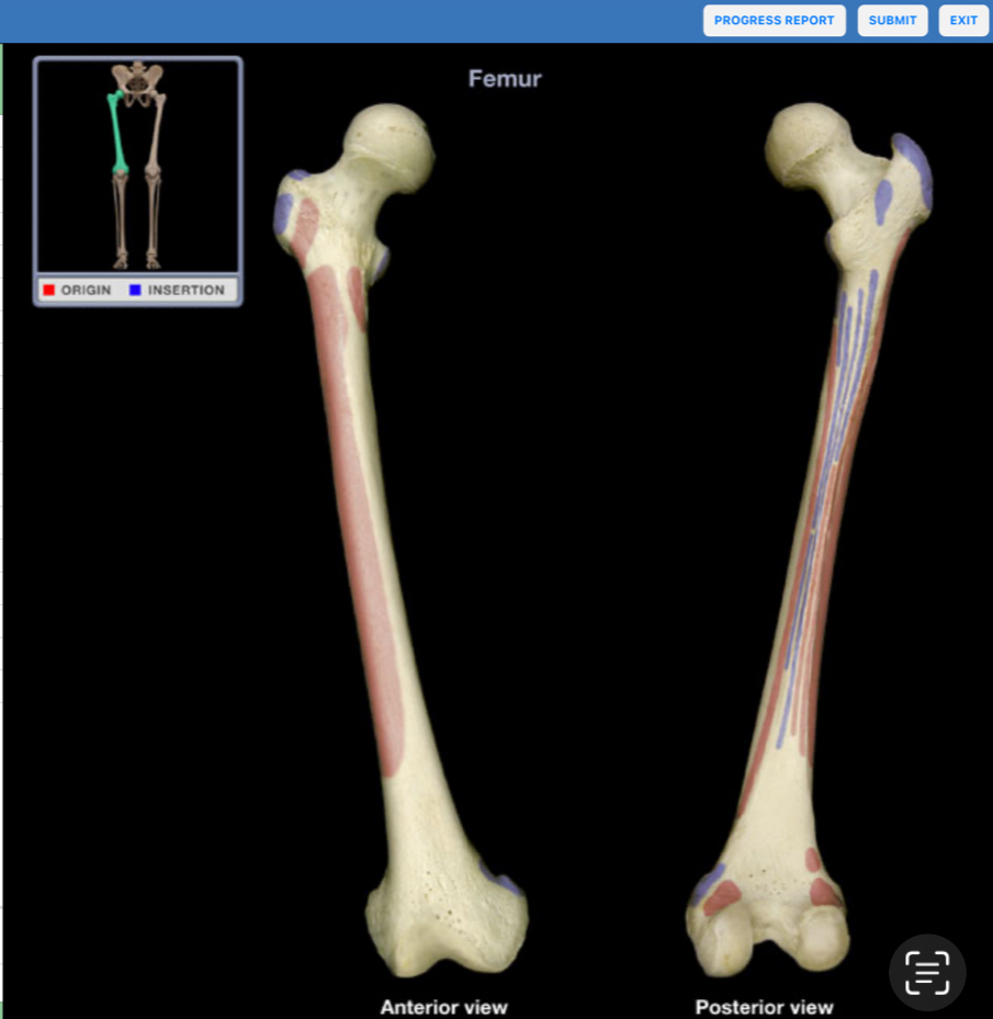 <p>What bone is shown?</p>