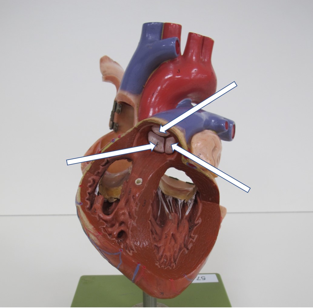 <p><span>Van welk bloedvat zijn er 3 kleppen aangeduid?</span></p>