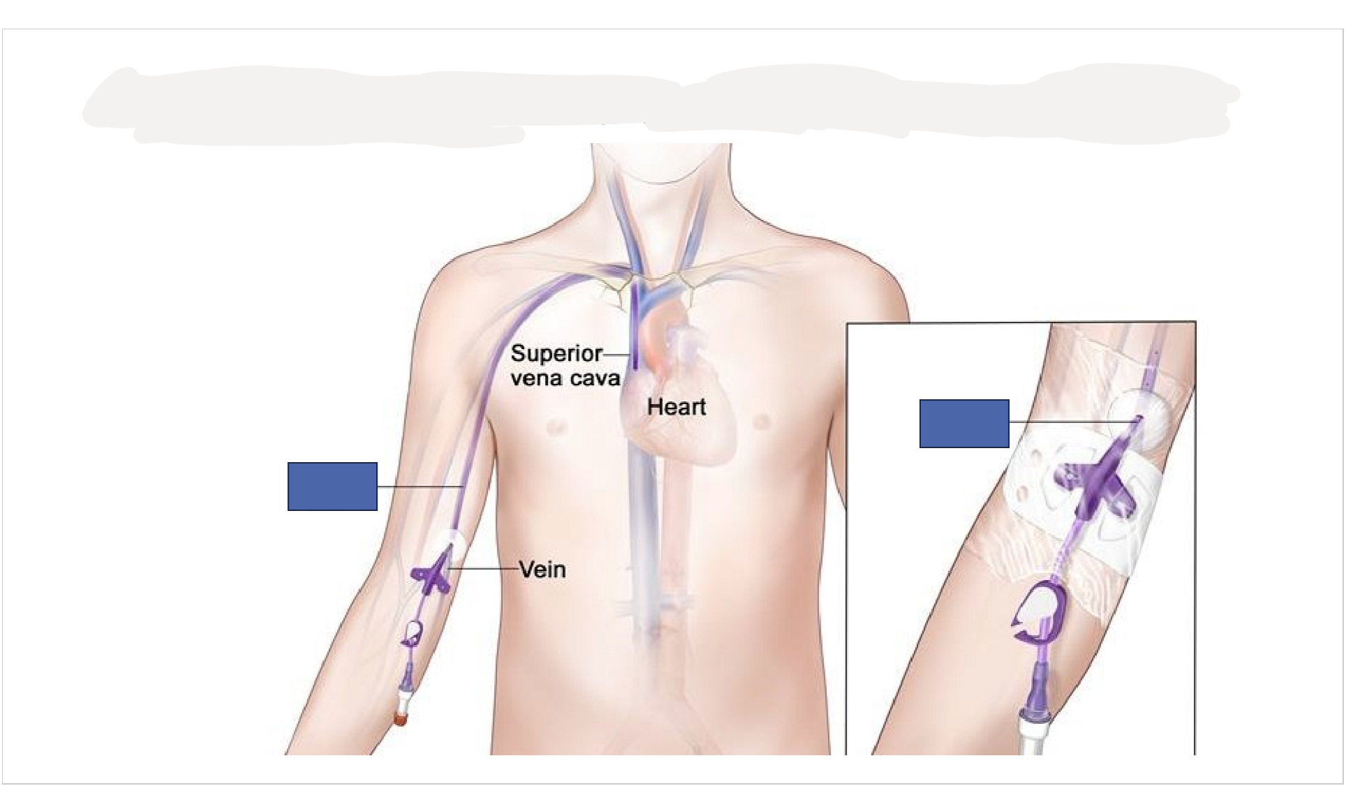 <p>What is this line and what is it used for?</p>