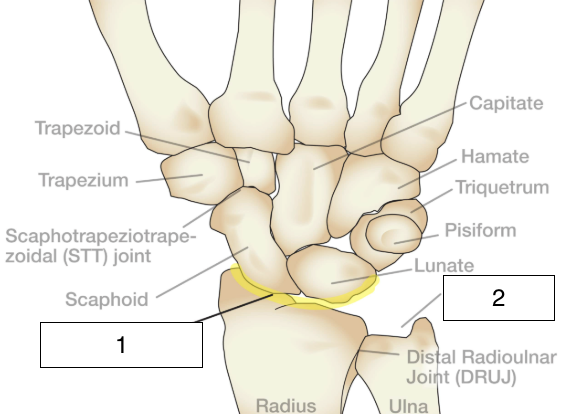 <p>what is the highlighted joint (number 1)?</p>