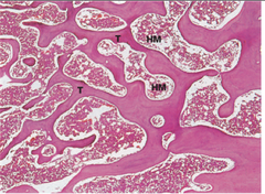 <p>Structure: Similar to compact bone with an outer covering, trabeculae, howship's lacunae, and bone marrow</p>