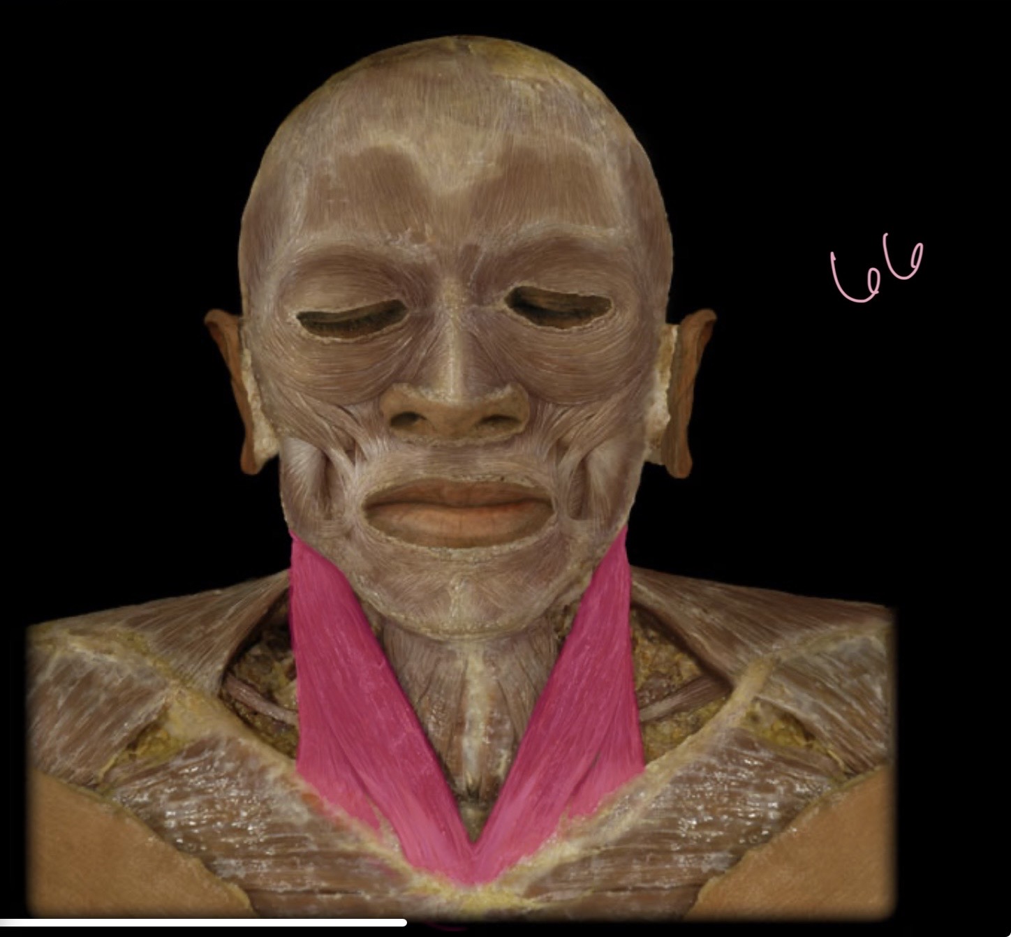 <p>Sternocleidmastoid</p>