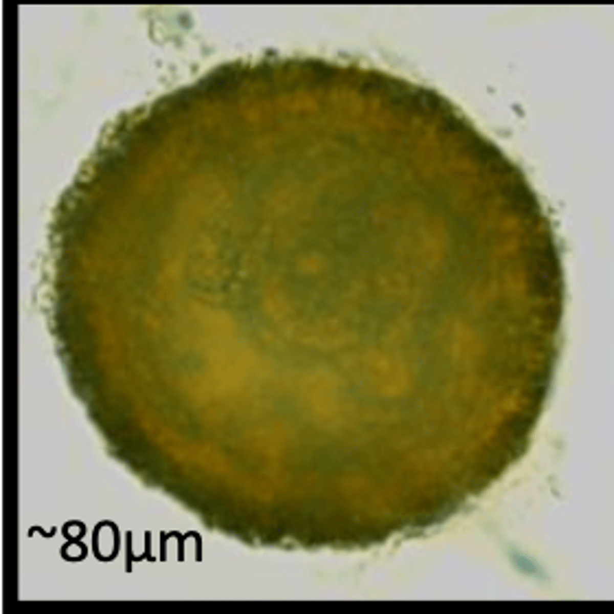 <p>Found in horses which are showing pneumonia-like symptoms and are poorly gaining weight. What parasite species does this egg belong to?</p>