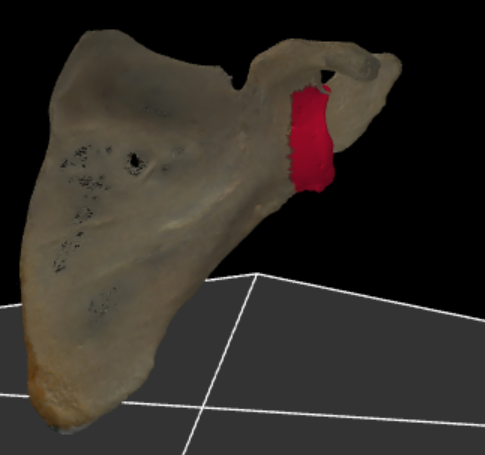 <p>de laterale hoek van de scapula</p>