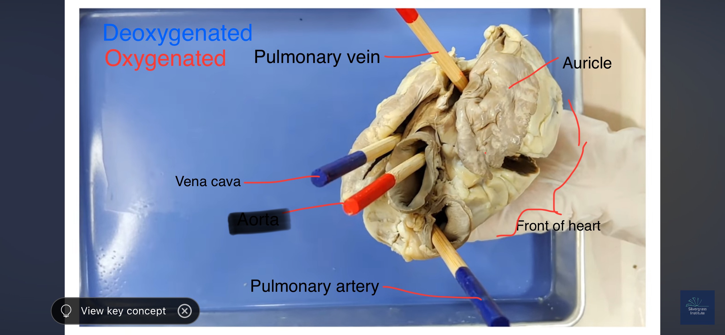 <p>Biggest Artery</p>