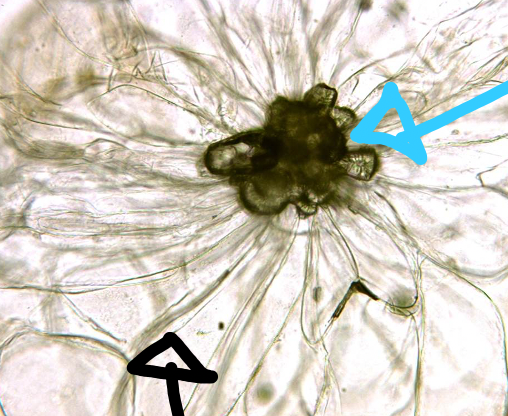 <ul><li><p>slcereid form of sclerenchyma (blue arrow)</p></li><li><p>parenchyma (black arrow)</p></li></ul>