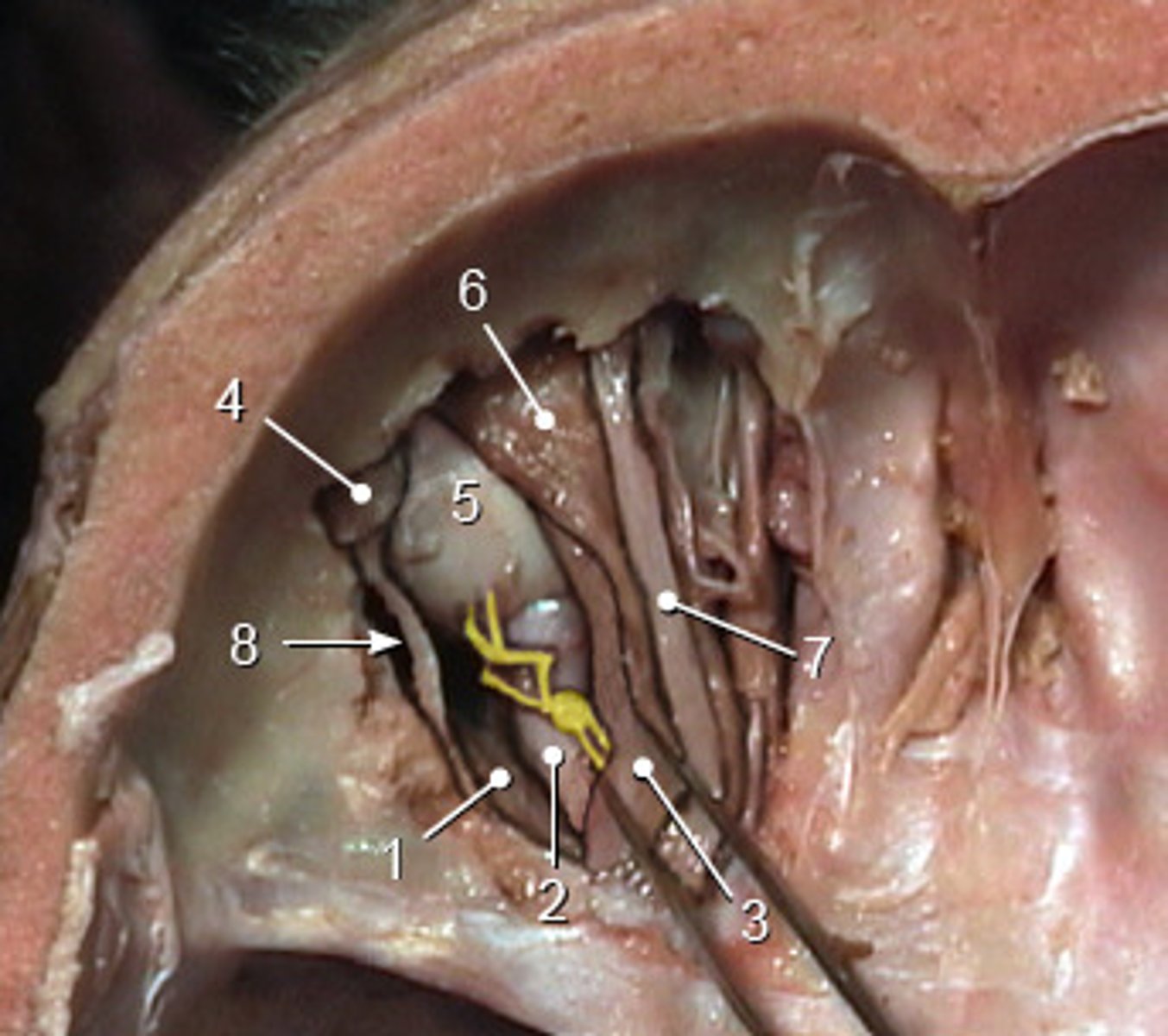 <p>(highlighted area) Site of postganglionic nerve cells that elicits constriction of pupil</p>