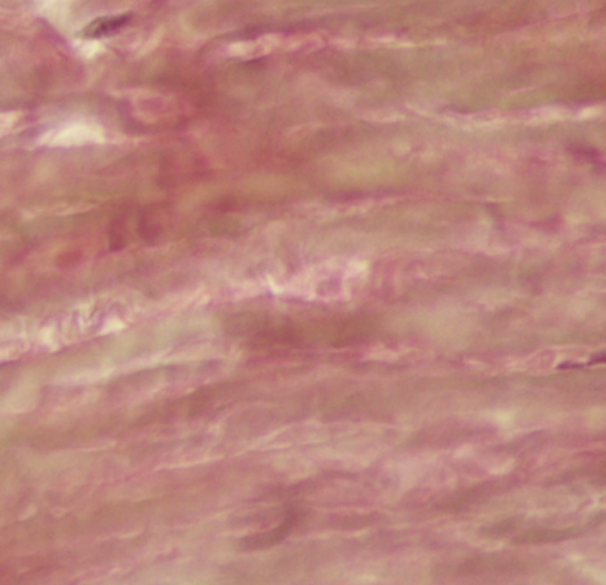 <p>what structure is stained pink? what structure is stained yellow?</p>