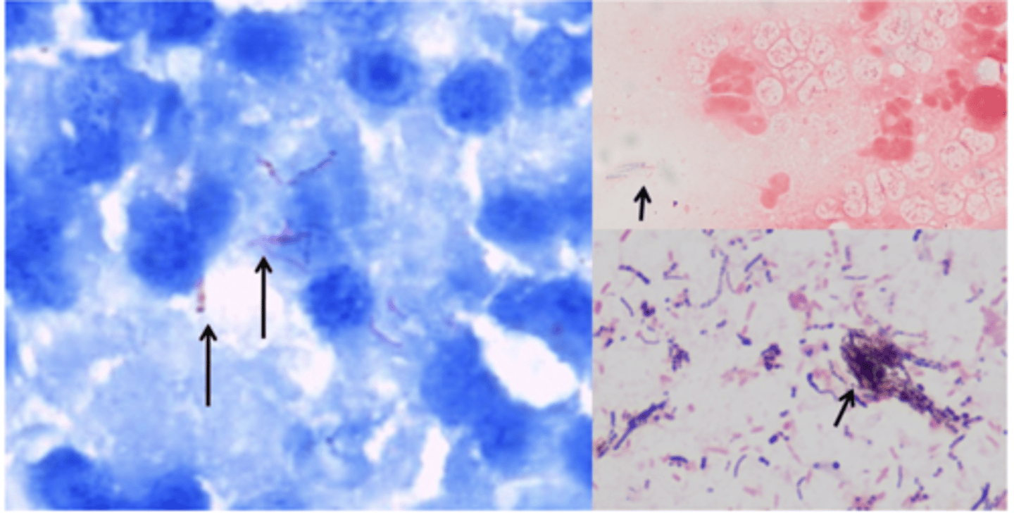 <p>1. Although they have a thick peptidoglycan layer, Mycobacterium rarely take up the Gram’s or Romanoski type stains.</p><p>2. Heated staining. Unlike other bacteria, they resist a strong acid decolourisation of the primary stain.</p><p>3. Ziehl-Neelsen stain will stain them a deep red and any other bacteria in the sample either the blue or green of the counterstain</p>