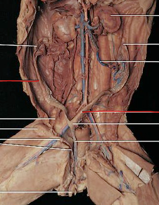 <p>houses the growing fetuses</p>