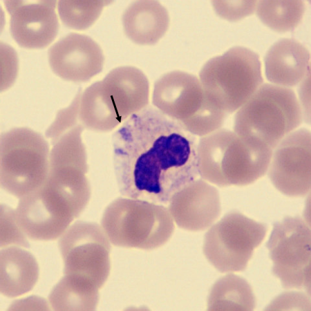 <p>What characteristics is this neutrophil showing?</p>