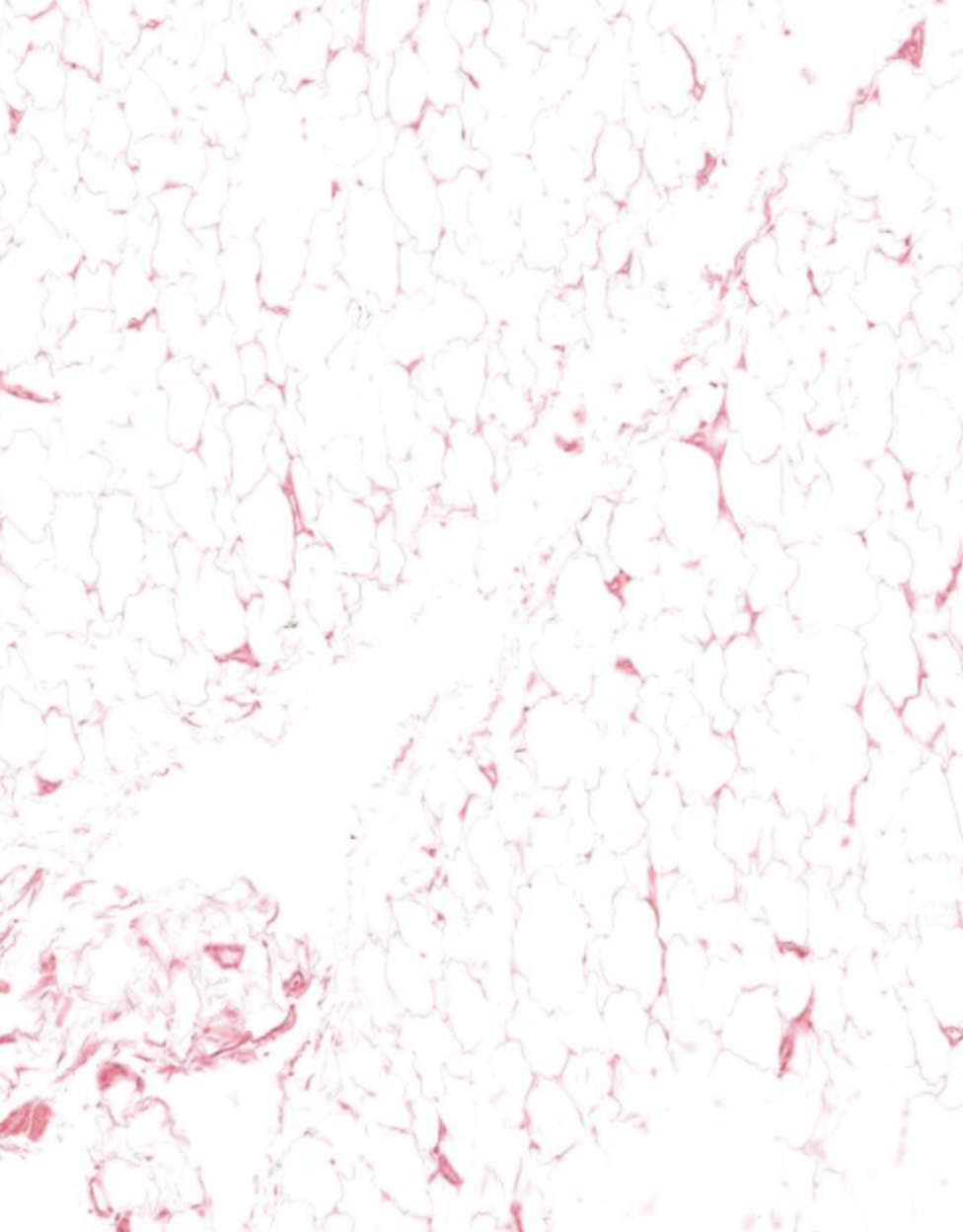 <p>Connective tissue proper that is loose and contains large numbers of adipocytes. The cells are empty because lipids are extracted during tissue preparation. It also contains small amounts of collagen fibers stained pink/red.</p>