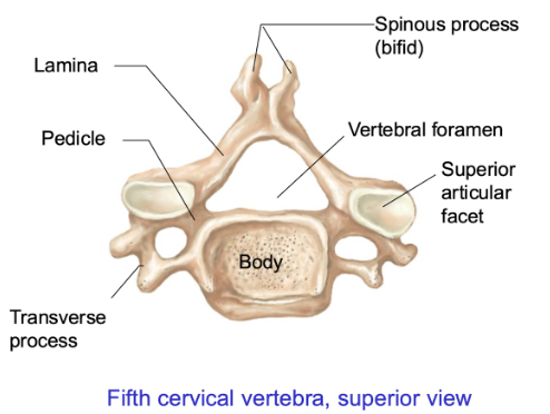 <ul><li><p><span style="background-color: transparent;"><span>Rectangularly-larger-flat vertebral body </span></span></p></li><li><p><span style="background-color: transparent;"><span>Has lamina and pedicle development </span></span></p></li><li><p><span style="background-color: transparent;"><span>Transverse process – has holes that allow blood vessels + nerves to go thru </span></span></p></li><li><p><span style="background-color: transparent;"><span>Vertebral foramen – gets smaller compared to C2 </span></span></p></li><li><p><span style="background-color: transparent;"><u><span>Bifid</span></u><span>: spinous process that breaks apart and have 2 points (clefted) – only for </span><strong><span>C2-C6</span></strong></span></p></li></ul><p></p>