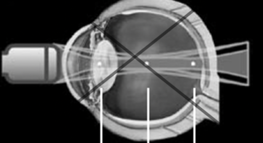 <p>What is an annular array </p>