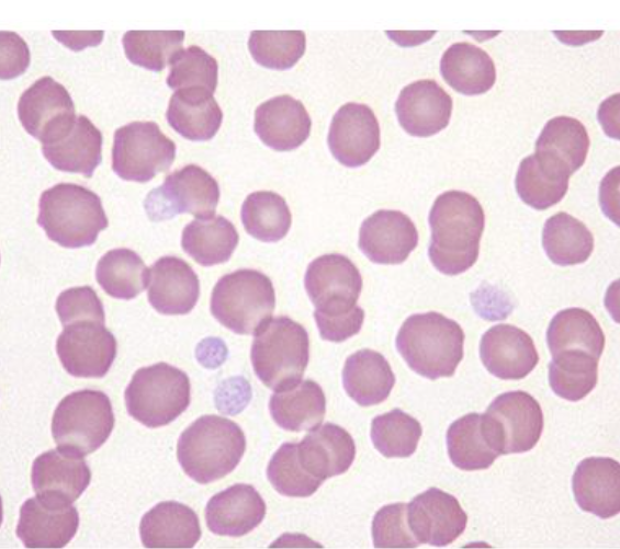 <p>equine blood smear</p><ul><li><p>largest of both</p></li><li><p>distinct central depression rather than clear cental pallor</p></li></ul><p></p>