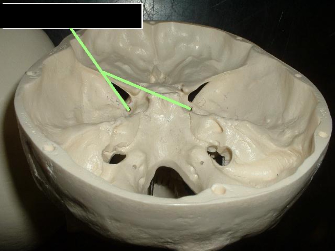 <p>a round hole below the superior orbital fissure</p>