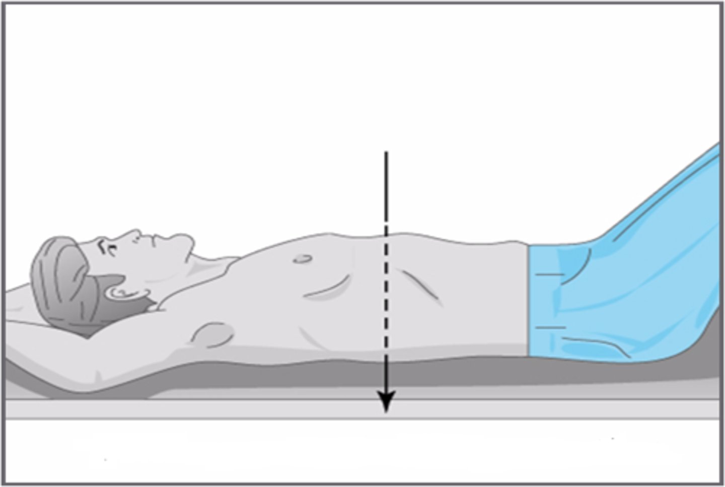 <p>patient faces away from the cassette</p><p>- usually done w/ portable equipment</p><p>- beam passes "anterior-to-posterior"</p><p>- may have technical issues</p><p>- tends to magnify the image</p>