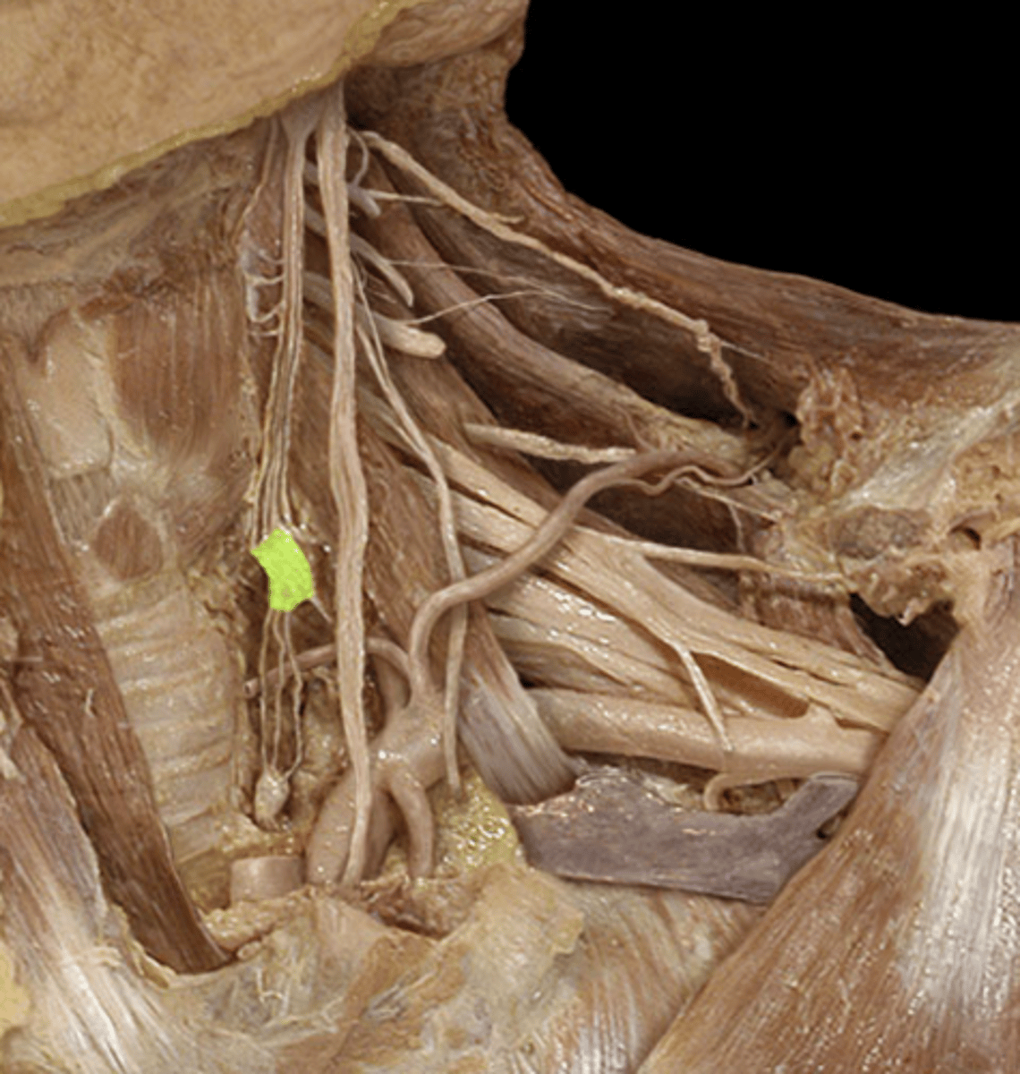 <p>This ganglion supplies <strong>sympathetic </strong>innervation to the trachea</p><p>- Travels along thyroid arteries</p><p>- <strong>Vasomotor</strong></p>