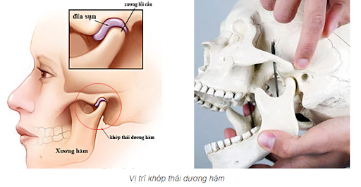 <p><strong>Cơ nào sau đây có 1 đầu bám vào đĩa khớp thái dương hàm?</strong></p><p>A. Cơ cắn</p><p>B. Cơ chân bướm trong</p><p>C. Cơ chân bướm ngoài</p><p>D. Cơ thái dương</p>