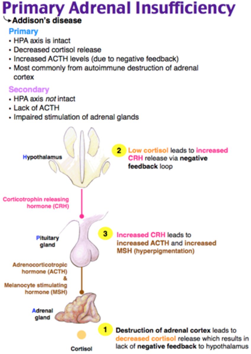 <p>Most commonly from autoimmune destruction of the adrenal cortex. Plasma ACTH is high and serum cortisol levels are low.</p><p>● Autoimmune destruction (most common as Addison disease)</p><p>● Tuberculosis (leading cause where TB is prevalent)</p><p>● Adrenal hemorrhage (i.e., sepsis, anticoagulation therapy, antiphospholipid antibody syndrome)</p><p>● Congenital</p>
