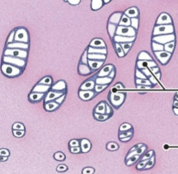 <p>what is this tissue</p>