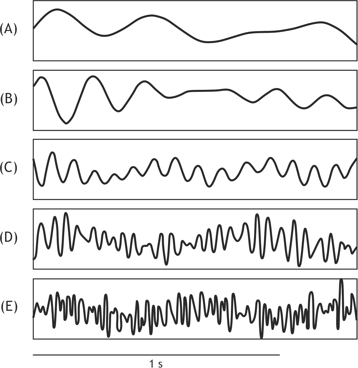 <p>28. Electroencephalography (EEG) is used to measure activity states of the cerebral cortex.</p><p>The EEG activity most commonly recorded in a relaxed adult lying with eyes closed most likely corresponds to the pattern shown in:</p><p>A. (A)</p><p>B. (B)</p><p>C. (C)</p><p>D. (D)</p><p>E. (E)</p>