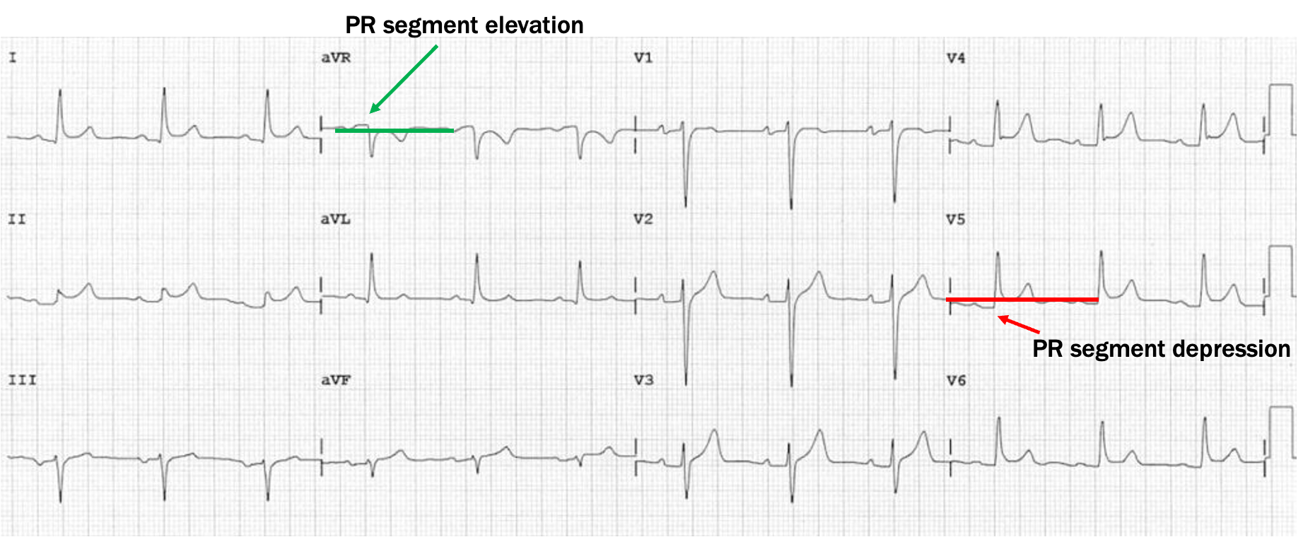 <p>what is this?</p>