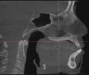 <p>what plane is this </p>