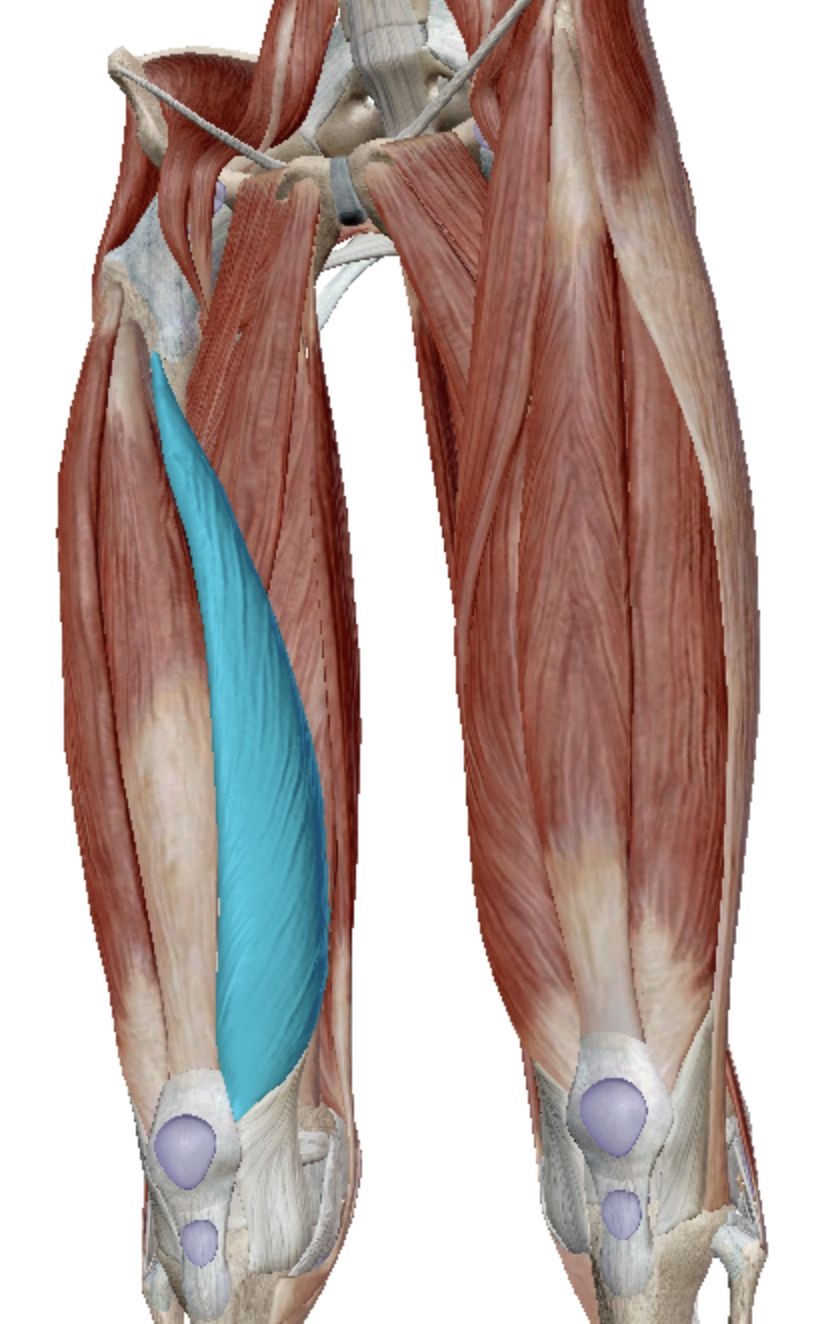 <p>Vastus Medialis</p>