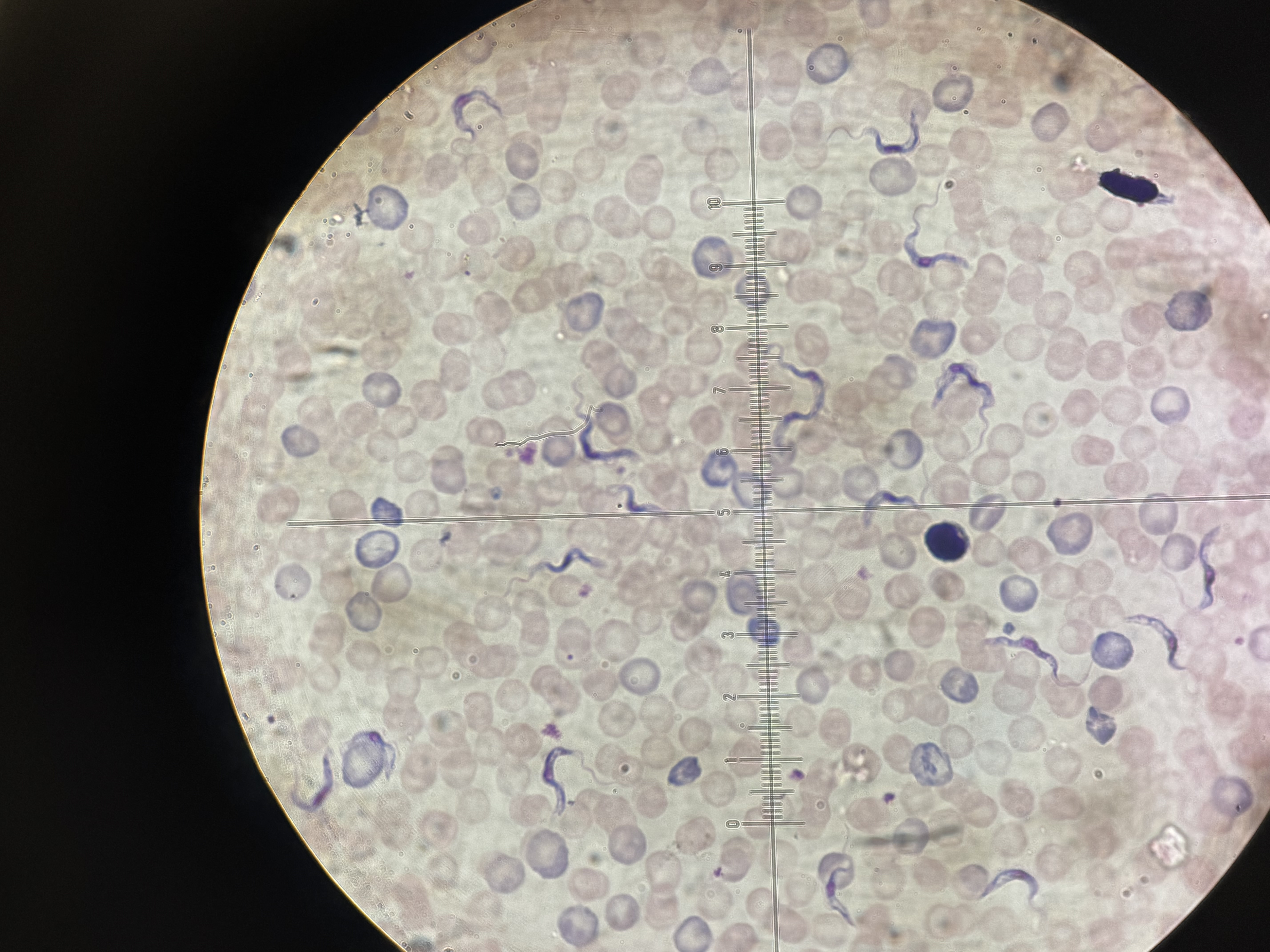 <p>Trypanosoma gambiense</p>