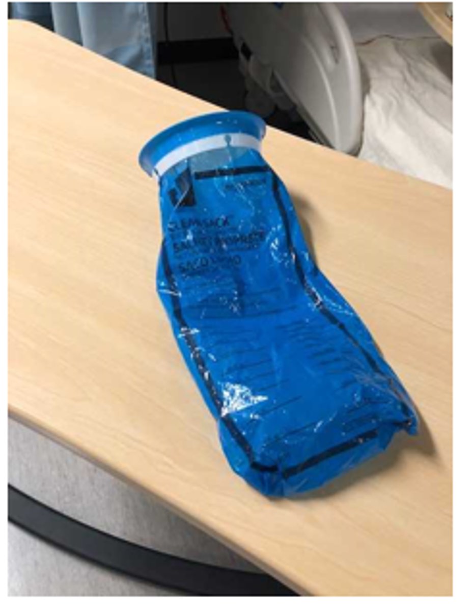 <p>What does image show?</p>