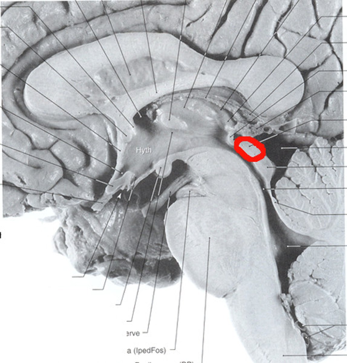 <p>Receives visual sensory input (midbrain)</p>