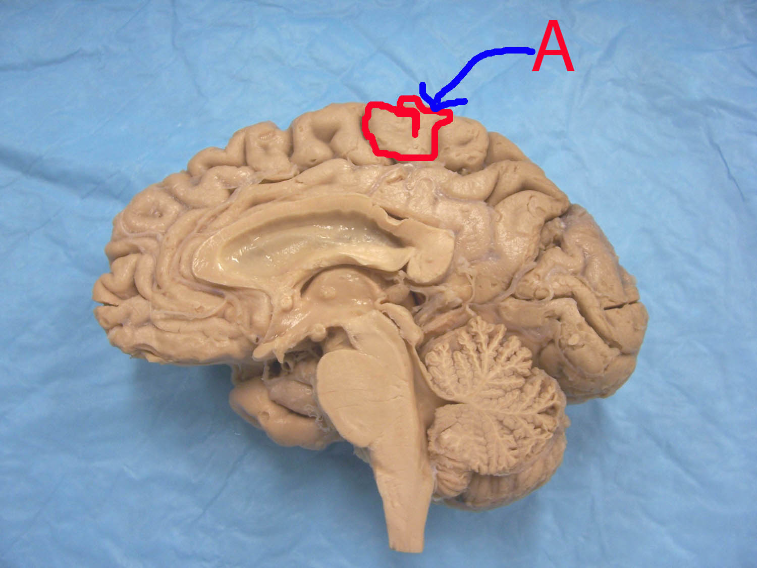 <p>Identify the structure indicated by the outline and letter “A”</p>