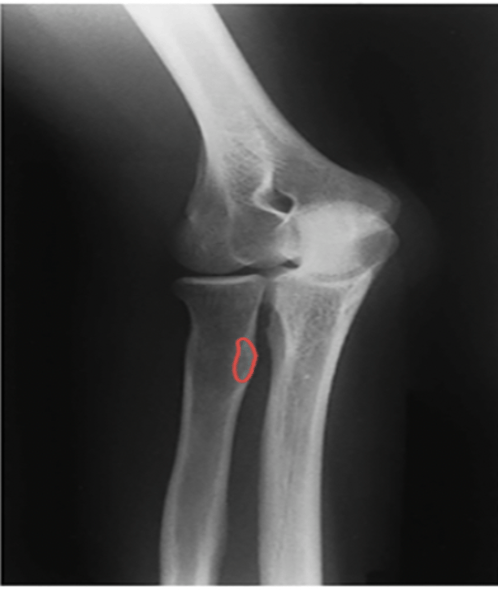 <p>What structure is highlighted?</p>