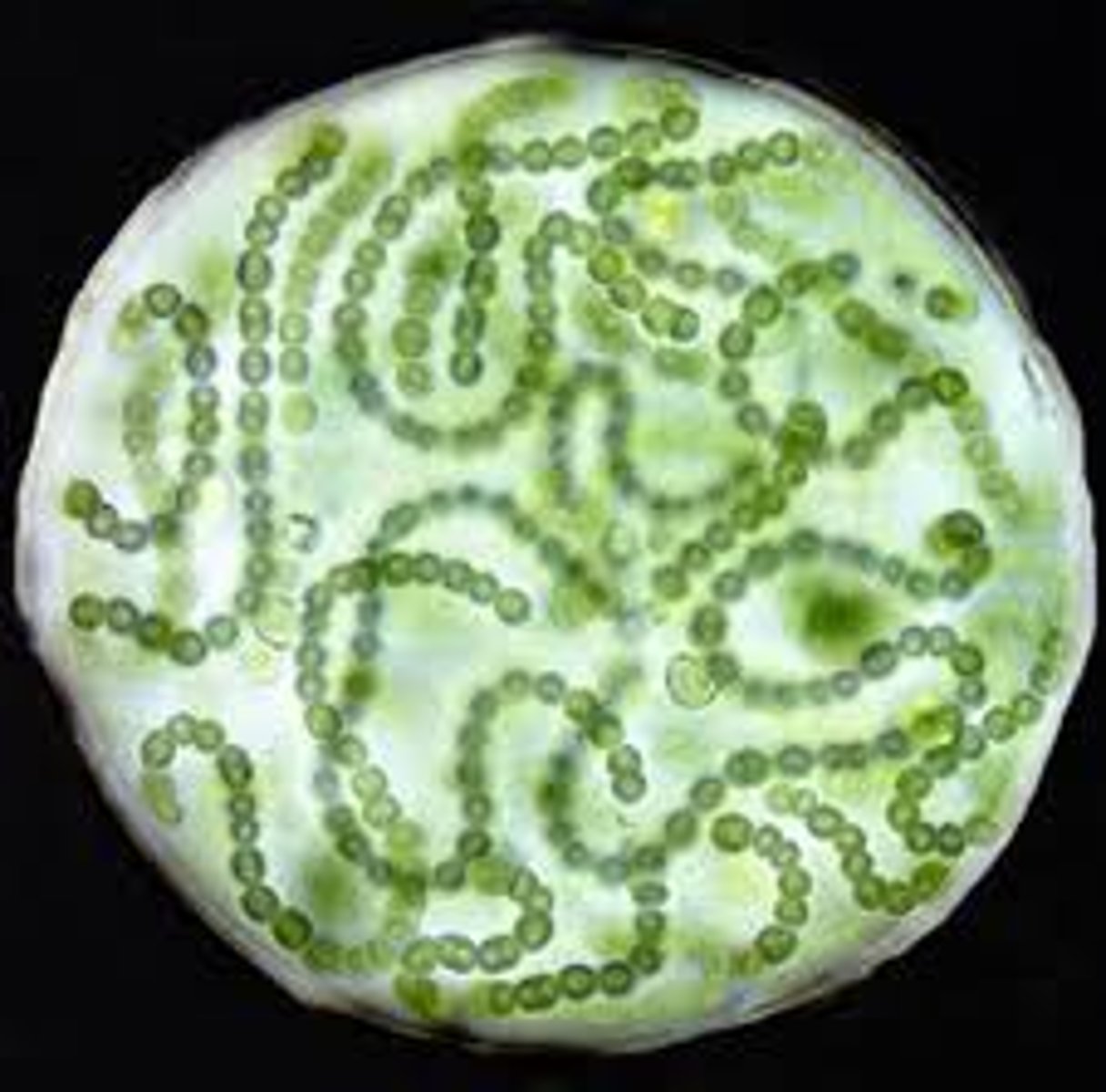 <p>gelatinous balls of filaments with heterocysts</p>