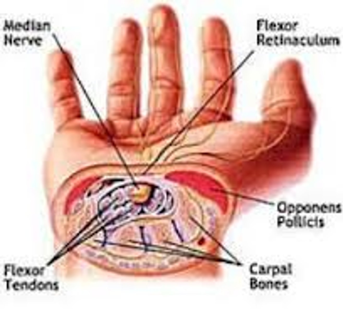 <p>Passageway for 9 tendons and major nerve, wall and floor are made up of carpal bones where the roof is flexor retinaculum. Overuse compresses the nerve causing pain and numbness</p>