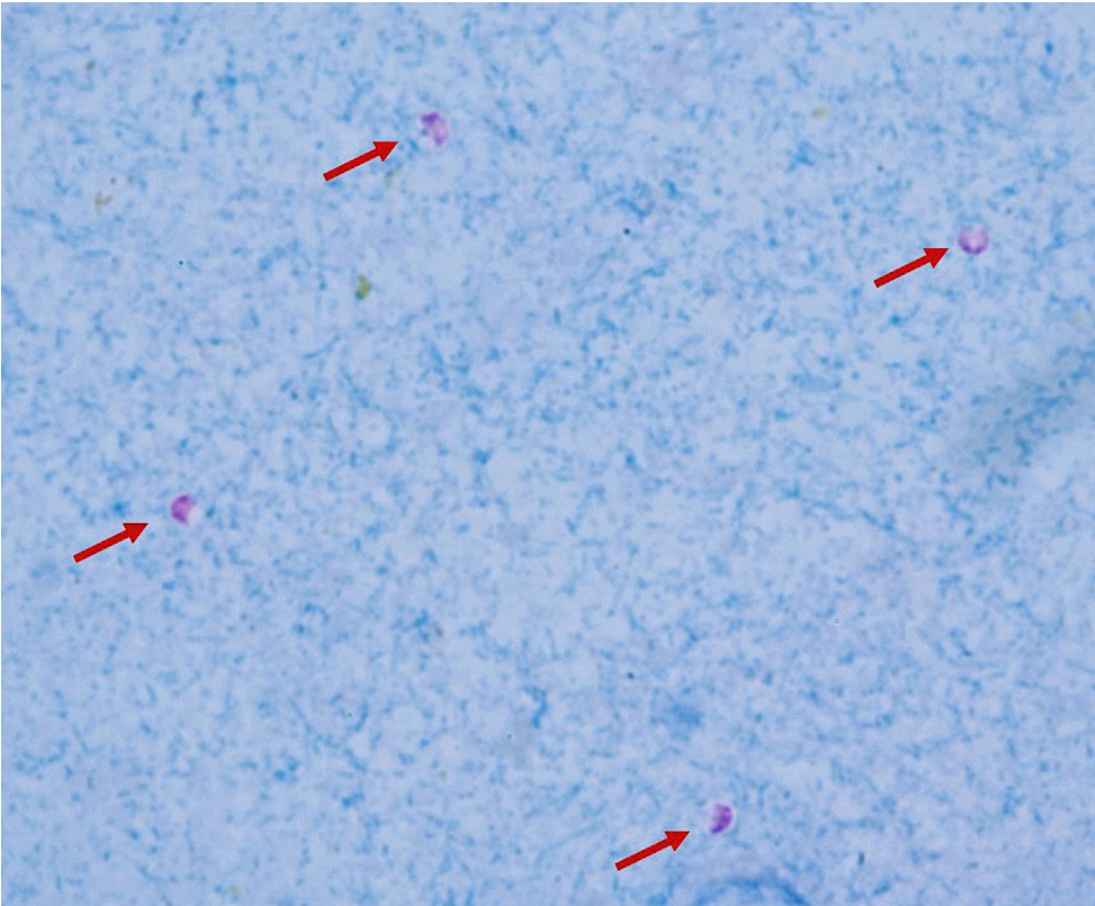 <ol start="12"><li><p>Diagnostic methods of cryptosporidiosis.</p><ul><li><p><em>picture of what some have got earlier - what is it?</em></p></li></ul></li></ol><p></p>