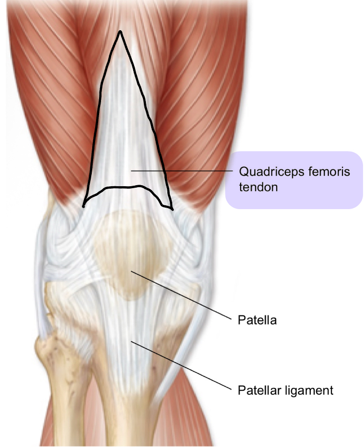 <p>quadriceps femoris tendon</p>