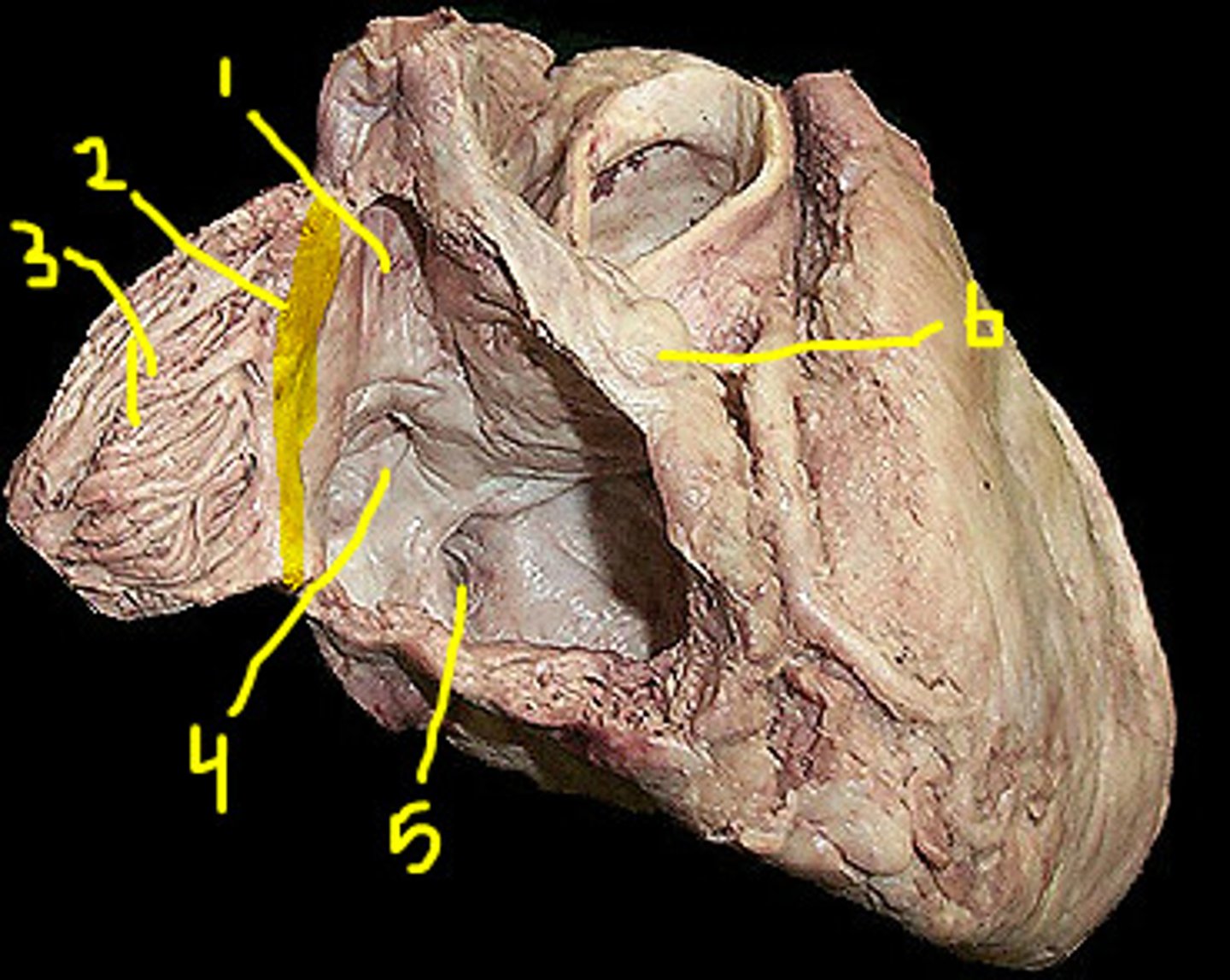 <p>surface. Below pectinate muscle. #2 on this picture.</p>