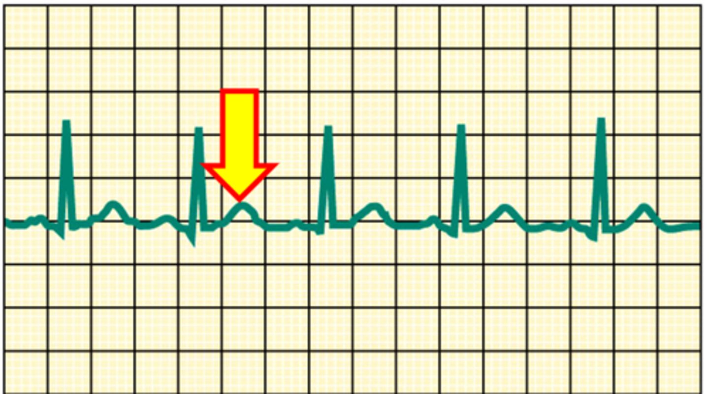 <p>Name the structure.</p>